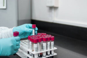 Nuevas pruebas que detectan influenza aviar en vacas lecheras